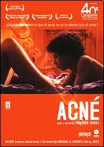 Acne (DVD)